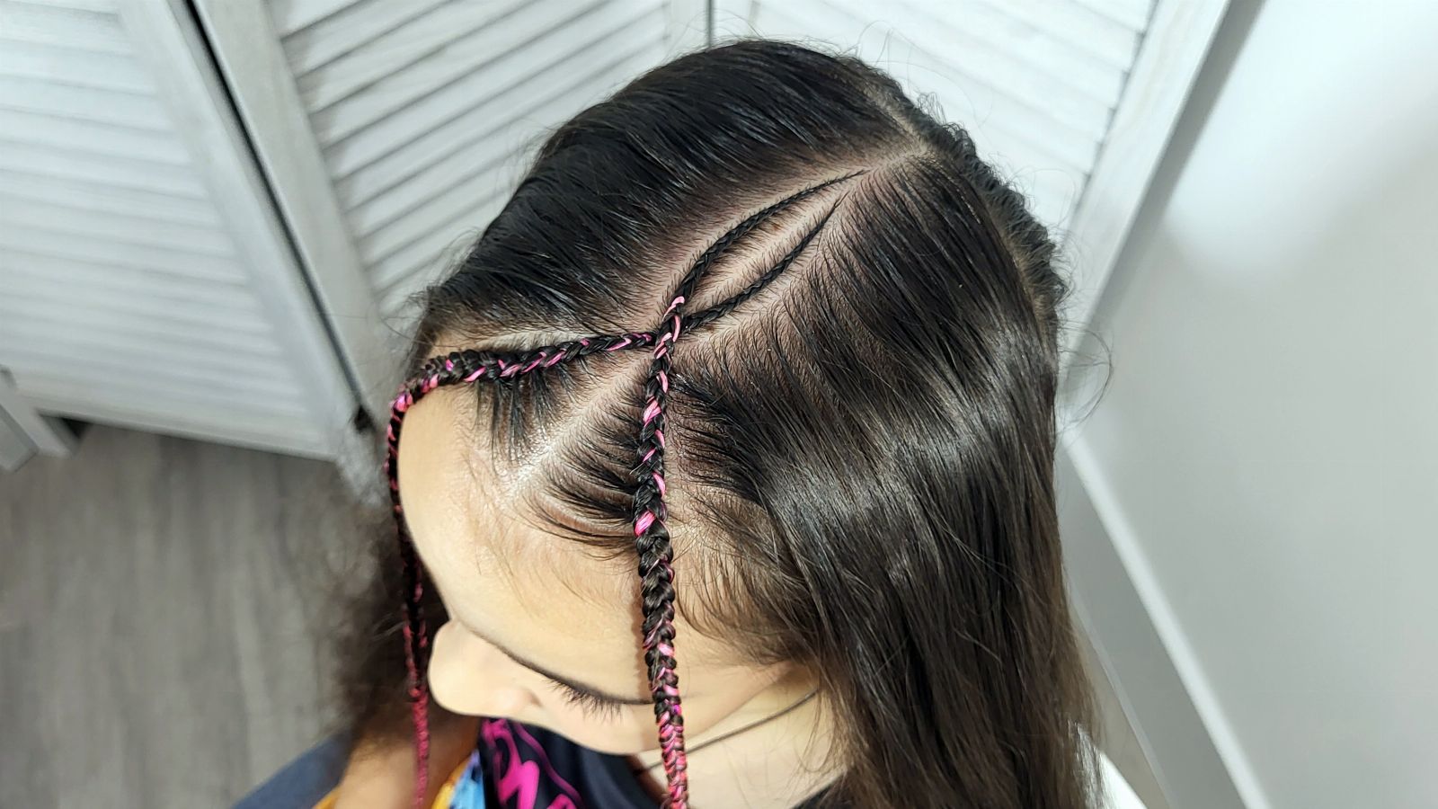 Redness, Bumps, and Pain: Warning Signs Braiders Should Never Ignore